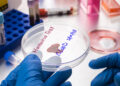 Hantavirus test, conceptual image.