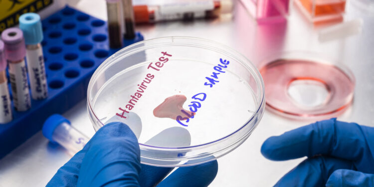 Hantavirus test, conceptual image.