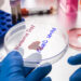 Hantavirus test, conceptual image.